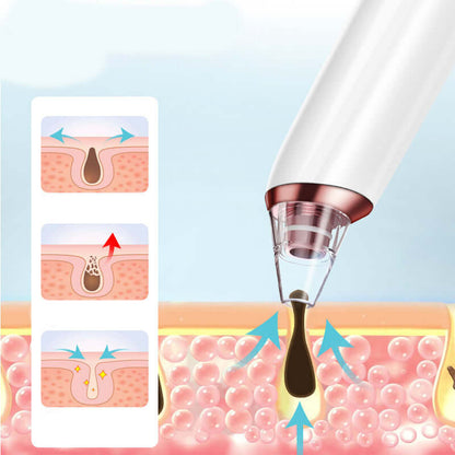 Compact facial tool to remove blackheads and impurities
