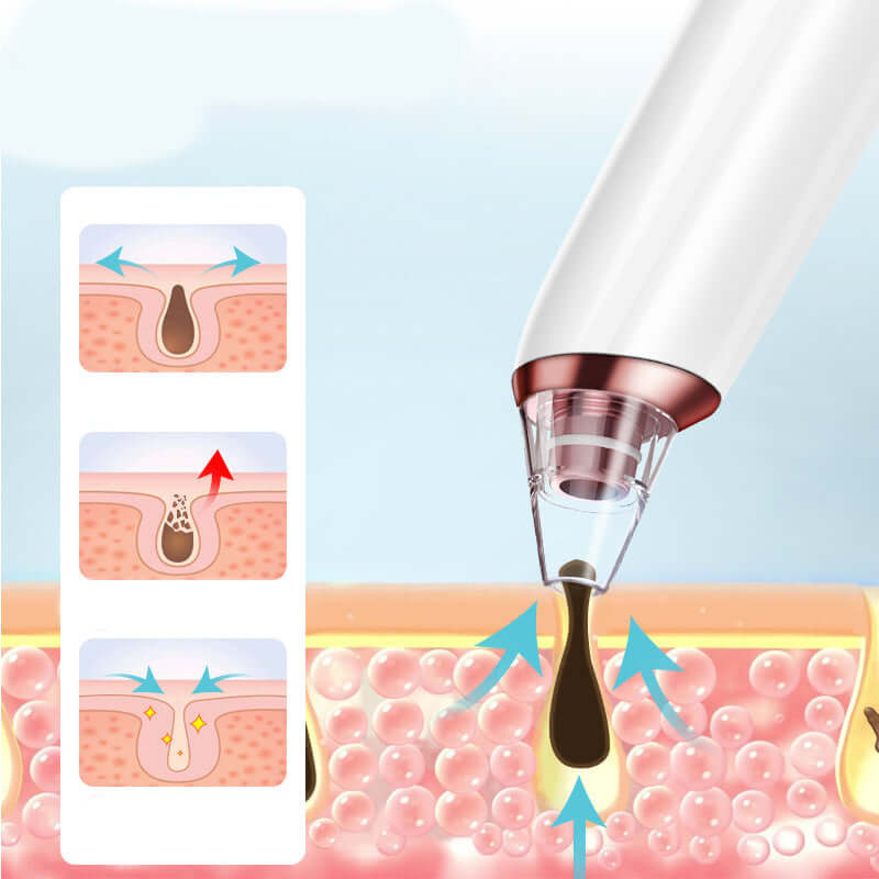 Compact facial tool to remove blackheads and impurities